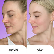 Glow Protect Kit